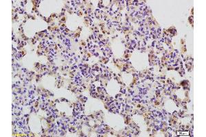 Formalin-fixed and paraffin embedded rat lung labeled with Anti-CD134 Polyclonal Antibody, Unconjugated (ABIN749108) at 1:200 followed by conjugation to the secondary antibody and DAB staining (TNFRSF4 antibody  (AA 101-200))