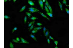 Immunofluorescence staining of Hela cells with ABIN7147441 at 1:100, counter-stained with DAPI. (CEP97 antibody  (AA 719-854))