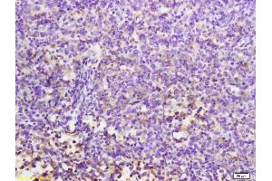 Formalin-fixed and paraffin embedded mouse lymphoma labeled with Anti-MuRF1/Trim63 Polyclonal Antibody, Unconjugated (ABIN687697) at 1:200 followed by conjugation to the secondary antibody and DAB staining. (CD7 antibody  (AA 181-240))