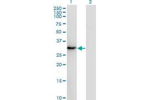 Western Blot analysis of SSX2 expression in transfected 293T cell line by SSX2 monoclonal antibody (M01), clone 1A4. (SSX2 antibody  (AA 1-223))