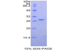 SDS-PAGE (SDS) image for HLA Class I Histocompatibility Antigen, alpha Chain E (HLA-E) (AA 22-358) protein (His tag) (ABIN1877573) (HLA-E Protein (AA 22-358) (His tag))