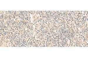 Immunohistochemistry of paraffin-embedded Human tonsil tissue using NGEF Polyclonal Antibody at dilution of 1:35(x200) (NGEF antibody)