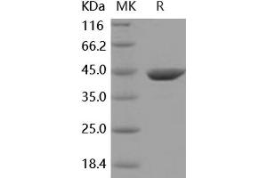 Western Blotting (WB) image for Aminoacylase 1 (ACY1) (Active) protein (His tag) (ABIN7320441) (Aminoacylase 1 Protein (ACY1) (His tag))
