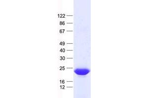 Validation with Western Blot (BTG1 Protein (His tag))