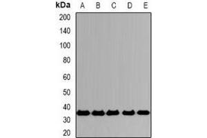 Western blot analysis of CD319 expression in A549 (A), SKOV3 (B), mouse spleen (C), mouse lung (D), rat testis (E) whole cell lysates. (SLAMF7 antibody)