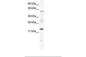 Image no. 1 for anti-Casein Kinase 1, gamma 1 (CSNK1G1) (AA 279-328) antibody (ABIN202567) (CSNK1G1 antibody  (AA 279-328))