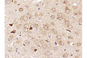 Paraformaldehyde-fixed, paraffin embedded rat brain, Antigen retrieval by boiling in sodium citrate buffer (pH6) for 15min, Block endogenous peroxidase by 3% hydrogen peroxide for 30 minutes,  Blocking buffer (normal goat serum) at 37°C for 20min, Antibody incubation with RPS6 Polyclonal Antibody (bs-3565R) at 1:400 overnight at 4°C, followed by a conjugated secondary and DAB staining. (RPS6 antibody  (AA 151-249))