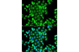 Immunofluorescence analysis of A549 cells using PAK2 antibody. (PAK2 antibody)