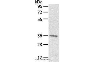 Western blot analysis of A431 cell, using PDLIM4 Polyclonal Antibody at dilution of 1:400