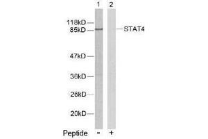 Image no. 2 for anti-Signal Transducer and Activator of Transcription 4 (STAT4) (Tyr693) antibody (ABIN197179) (STAT4 antibody  (Tyr693))