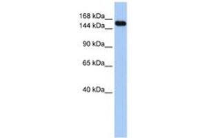 Image no. 1 for anti-Ubiquitin Protein Ligase E3A (ube3a) (C-Term) antibody (ABIN6743133) (ube3a antibody  (C-Term))
