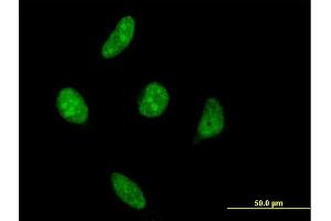 Immunofluorescence (IF) image for anti-Vaccinia Related Kinase 1 (VRK1) (AA 287-396) antibody (ABIN521352)