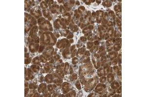 Immunohistochemical staining of human pancreas with SEC23B polyclonal antibody  shows strong cytoplasmic positivity in exocrine glandular cells and moderate staining in Islet cells.