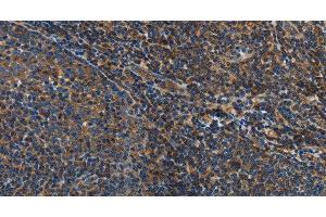 Immunohistochemistry of paraffin-embedded Human tonsil tissue using IL17D Polyclonal Antibody at dilution 1:50 (IL17D antibody)