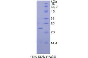 SDS-PAGE analysis of Horse Interleukin 1 alpha Protein. (IL1A Protein)