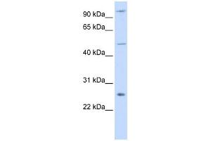 WB Suggested Anti-TRAF4 Antibody Titration:  0. (TRAF4 antibody  (Middle Region))