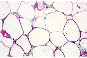 Image no. 1 for anti-G Protein-Coupled Receptor 77 (GPR77) (Extracellular Domain) antibody (ABIN1048365) (GPR77 antibody  (Extracellular Domain))