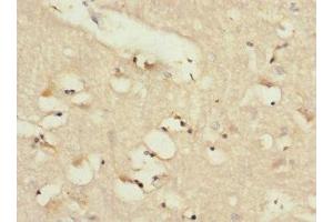 Immunohistochemistry of paraffin-embedded human brain tissue using ABIN7143394 at dilution of 1:100 (LPHN2 antibody  (AA 400-480))