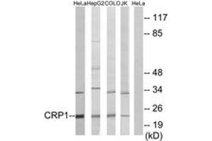 Western blot analysis of extracts from HeLa/HepG2/COLO/Jurkat cells, using CRP1 Antibody. (CSRP1 antibody  (AA 51-100))