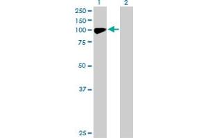 Western Blotting (WB) image for anti-Choroideremia-Like (Rab Escort Protein 2) (CHML) (AA 1-656) antibody (ABIN514396)