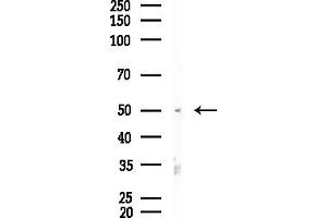 anti-Cytochrome P450, Family 1, Subfamily B, Polypeptide 1 (CYP1B1) (Internal Region) antibody