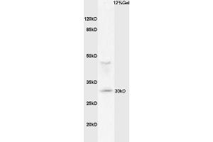 Mouse lung lysates probed with Anti MHC Class II Polyclonal Antibody, Unconjugated (ABIN1713842) at 1:200 overnight at 4 °C. (MHC Class II antibody  (AA 111-200))