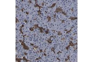 Immunohistochemical staining of human pancreas with DSCR4 polyclonal antibody  shows strong cytoplasmic positivity in pancreatic duct cells. (DSCR4 antibody)