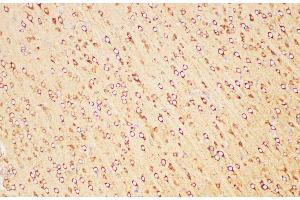 PSMA antibody