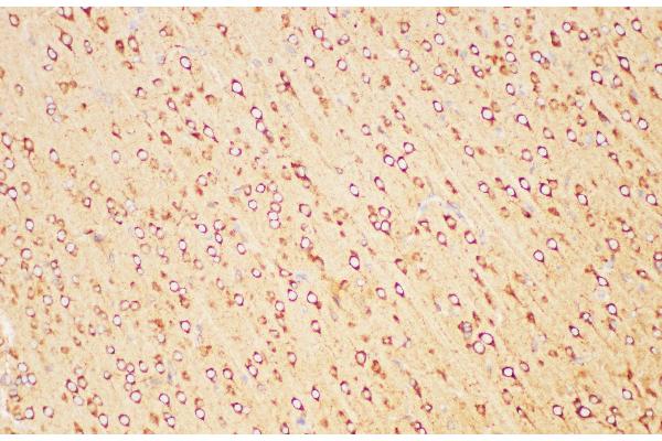 PSMA antibody