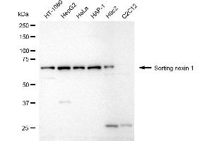 Western blotting analysis using sorting nexin 1 antibody (ABIN7800408).