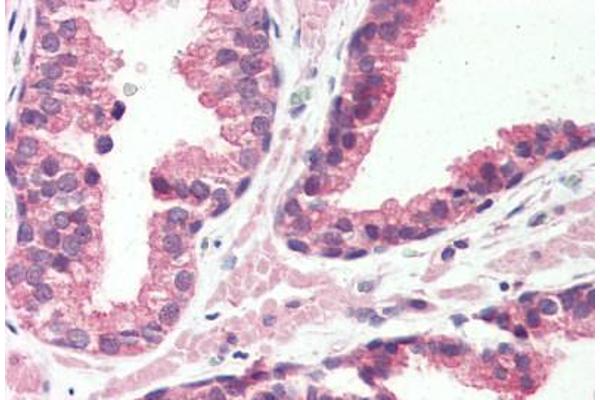 G Protein-Coupled Receptor 126 antibody  (N-Term)