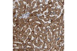 Immunohistochemical staining (Formalin-fixed paraffin-embedded sections) of human liver with ACAT1 polyclonal antibody  shows strong cytoplasmic positivity in hepatocytes.