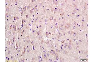 Formalin-fixed and paraffin embedded rat brain labeled with Rabbit Anti KRIT1 Polyclonal Antibody, Unconjugated (ABIN1387606) at 1:200 followed by conjugation to the secondary antibody and DAB staining