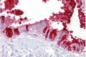 Immunohistochemistry with Lung, respiratory epithelium tissue at an antibody concentration of 5µg/ml using anti-SCGB1A1 antibody (ARP41524_P050) (SCGB1A1 antibody  (Middle Region))