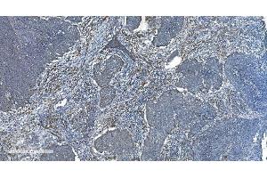 IHC analysis of TIMM8A/DDP using anti-TIMM8A/DDP antibody (ABIN7600039).