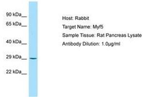 Image no. 1 for anti-Myogenic Factor 5 (MYF5) (AA 51-100) antibody (ABIN6749815)