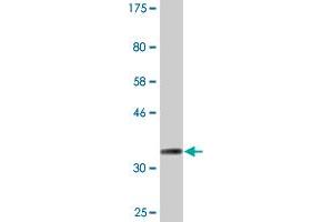 Western Blot detection against Immunogen (35. (CKMT1B antibody  (AA 327-417))