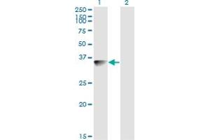 Western Blot analysis of BLVRA expression in transfected 293T cell line by BLVRA monoclonal antibody (M03), clone S2. (Biliverdin Reductase antibody  (AA 1-296))