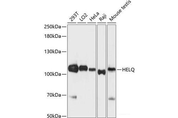 HEL308 anticorps