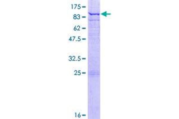 ETFDH Protein (AA 1-617) (GST tag)