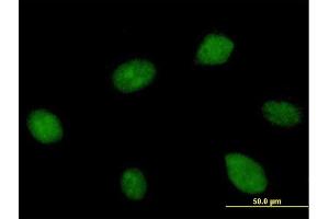 Immunofluorescence of purified MaxPab antibody to KIAA1604 on HeLa cell. (CWC22 antibody  (AA 1-908))