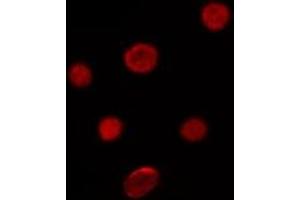 ABIN6276688 staining Hela by IF/ICC. (p21 antibody  (Internal Region))