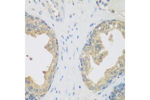 Immunohistochemistry of paraffin-embedded human prostate using ENPEP antibody (ABIN5975067) at dilution of 1/200 (40x lens).