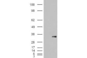 Western Blotting (WB) image for anti-WNT1 Inducible Signaling Pathway Protein 1 (WISP1) (C-Term) antibody (ABIN2466452) (WISP1 antibody  (C-Term))