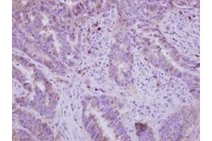 Image no. 1 for anti-Fatty Acid Desaturase 1 (FADS1) (AA 247-444) antibody (ABIN1498179) (FADS1 antibody  (AA 247-444))