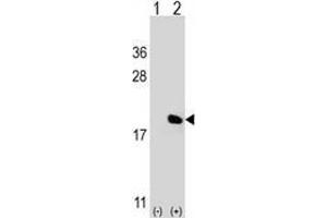 Western blot analysis of IL17A (arrow) using Interleukin-17A (IL17A) Antibody ; 293 cell lysates (2 ug/lane) either nontransfected (Lane 1) or transiently transfected (Lane 2) with the IL17A gene. (Interleukin 17a antibody  (Middle Region))