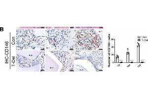 Infiltration of Cells and osteogenic differentiation MSCs around BCP dependent on T cells. (SETD7 antibody  (AA 1-366))