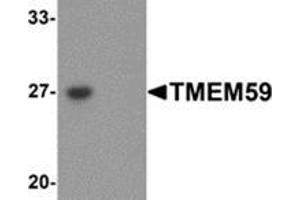 Western blot analysis of TMEM59 in human kidney tissue lysate with TMEM59 antibody at 1 μg/mL in (left) the absence and (right) the presence of blocking peptide.