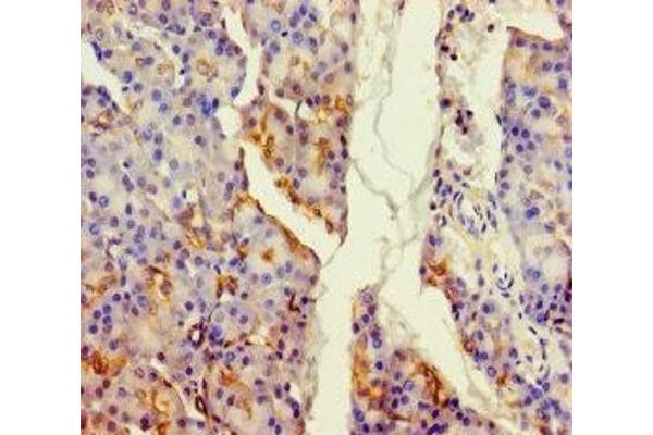 ALDH1L2 antibody  (AA 263-562)