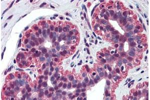 Human Breast (formalin-fixed, paraffin-embedded) stained with TP73 antibody ABIN298091 at 5 ug/ml followed by biotinylated anti-mouse IgG secondary antibody ABIN481714, alkaline phosphatase-streptavidin and chromogen.